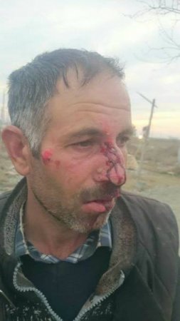 Başçı müavini Xocalı faciəsi günü Xocalı sakinini döydürüb –