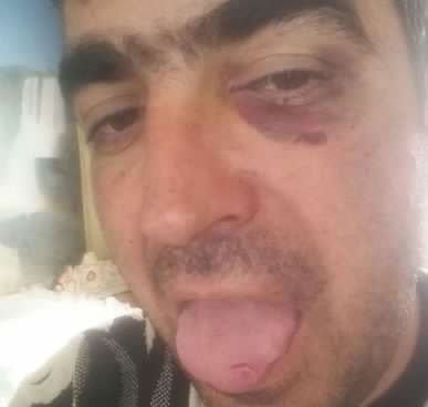 Gəncənin Nizami polisində dəhşətli hadisə – 